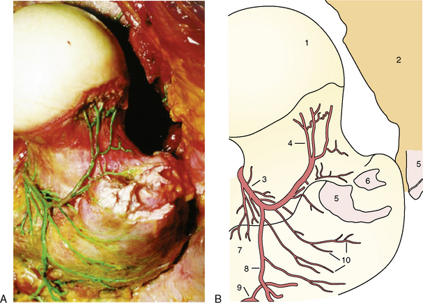 Pelvic incidence and acetabular anatomy