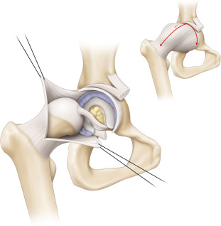 Capsule management diagram